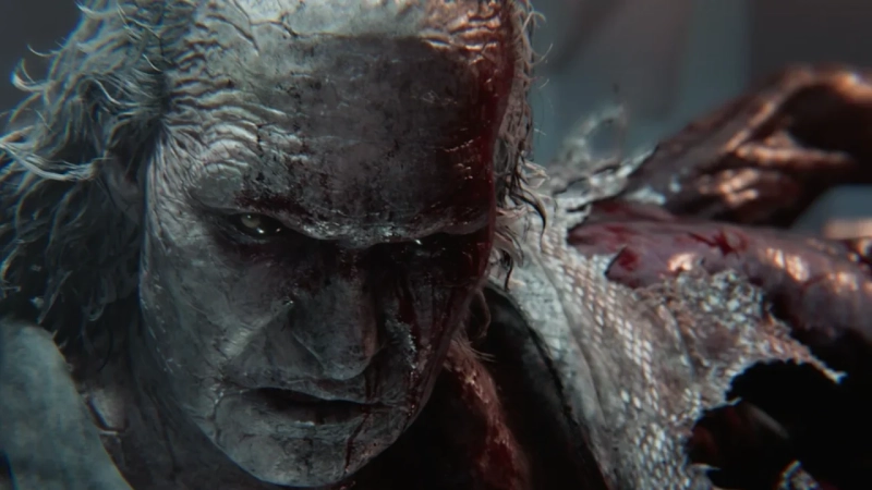 Resident Evil Requiem Boss Guide: Exterminating Victor Gideon